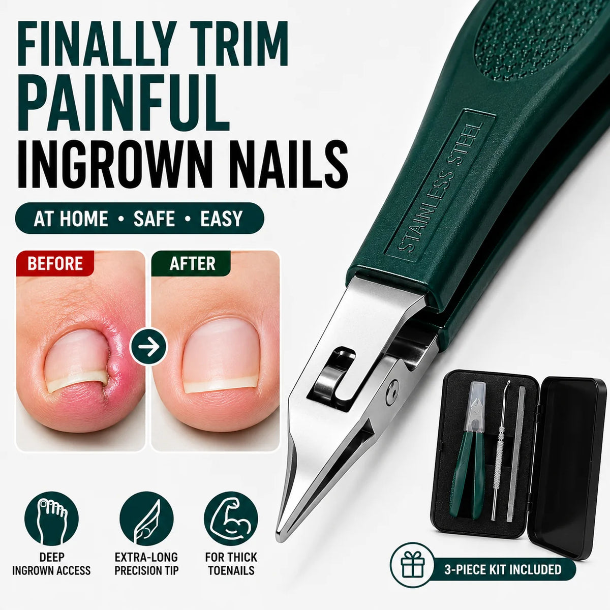 Nail Clipper Set for Thick Toenails | Premium 3-Piece Grooming Kit ✂️🛡️